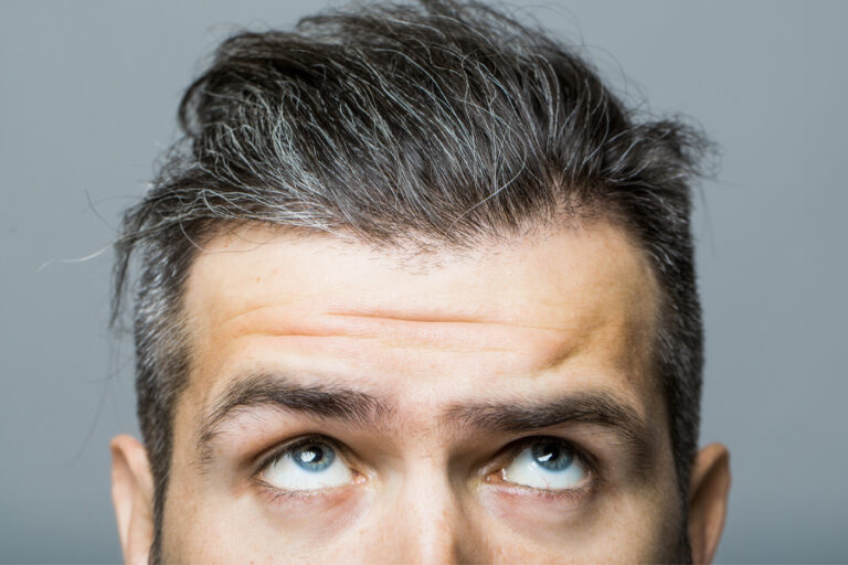 Male Face With Forehead Wrinkles