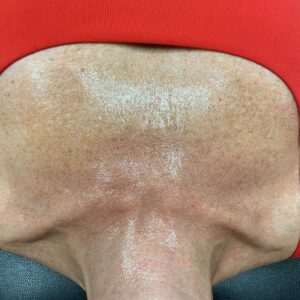 BBL Neck