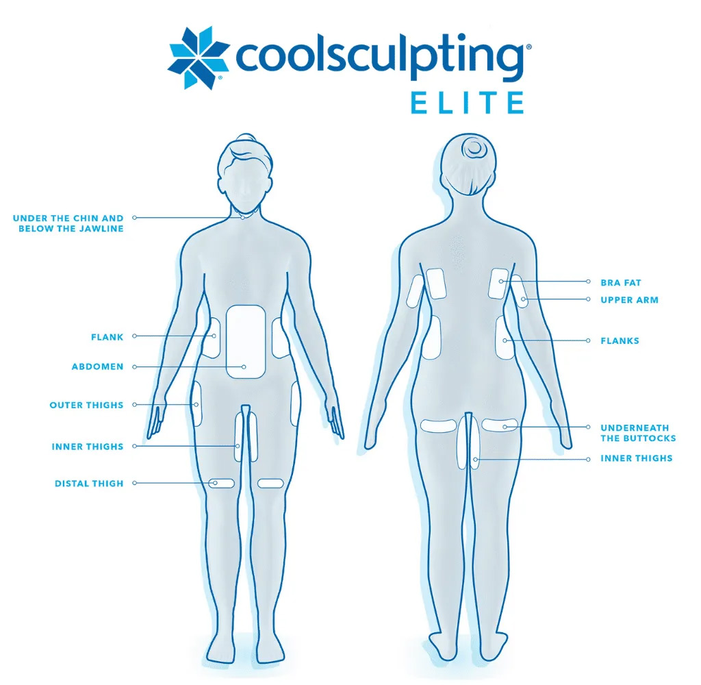 Coolsculpting Elite Treatment Areas