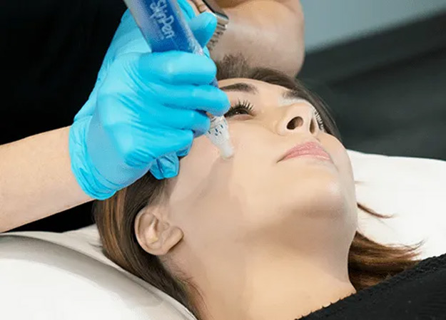 Skinpen Microneedling