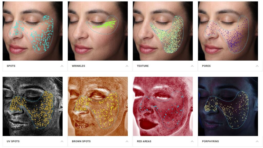 Visia Skin Analysis