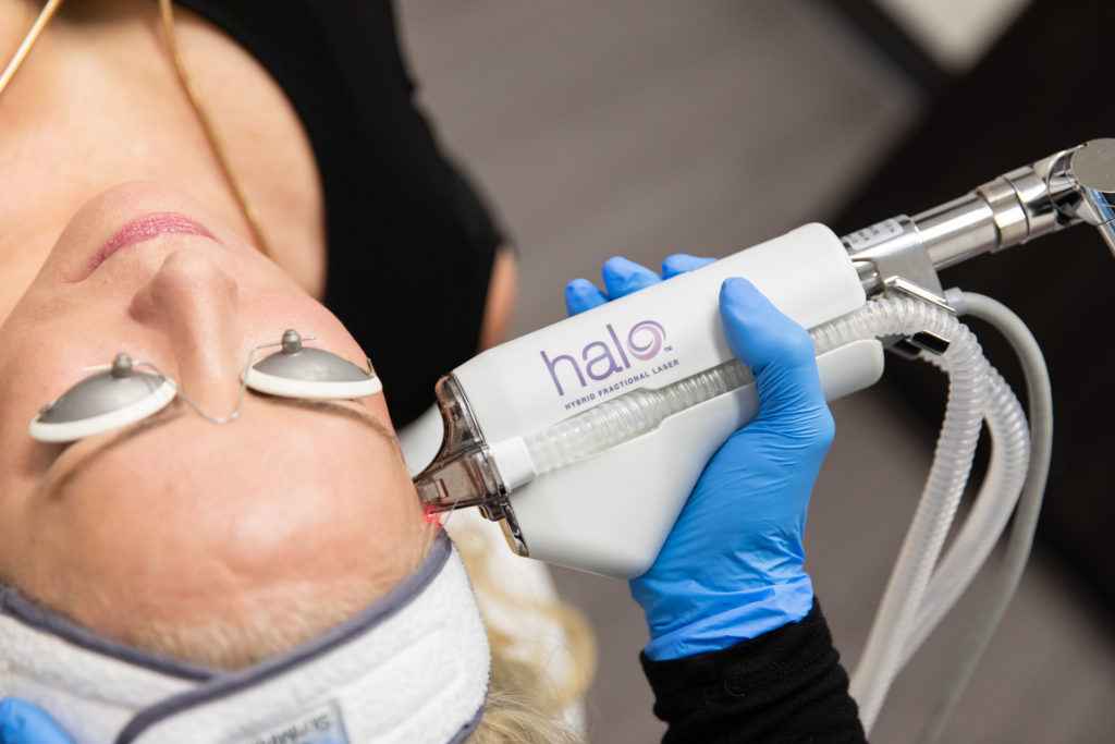 Halo Laser Des Moines