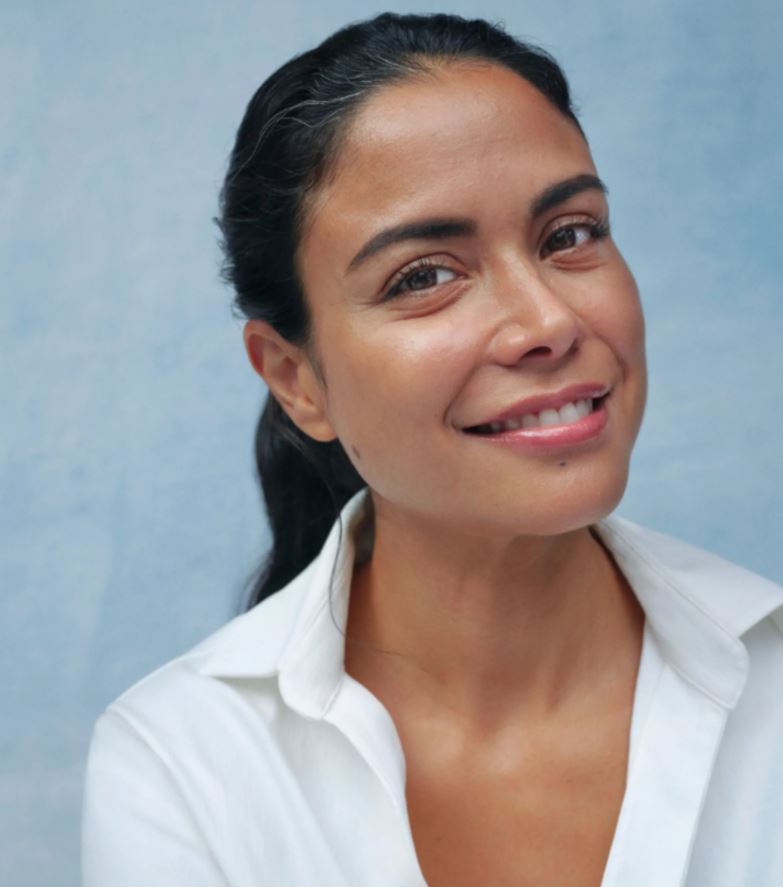 Juvederm Filler