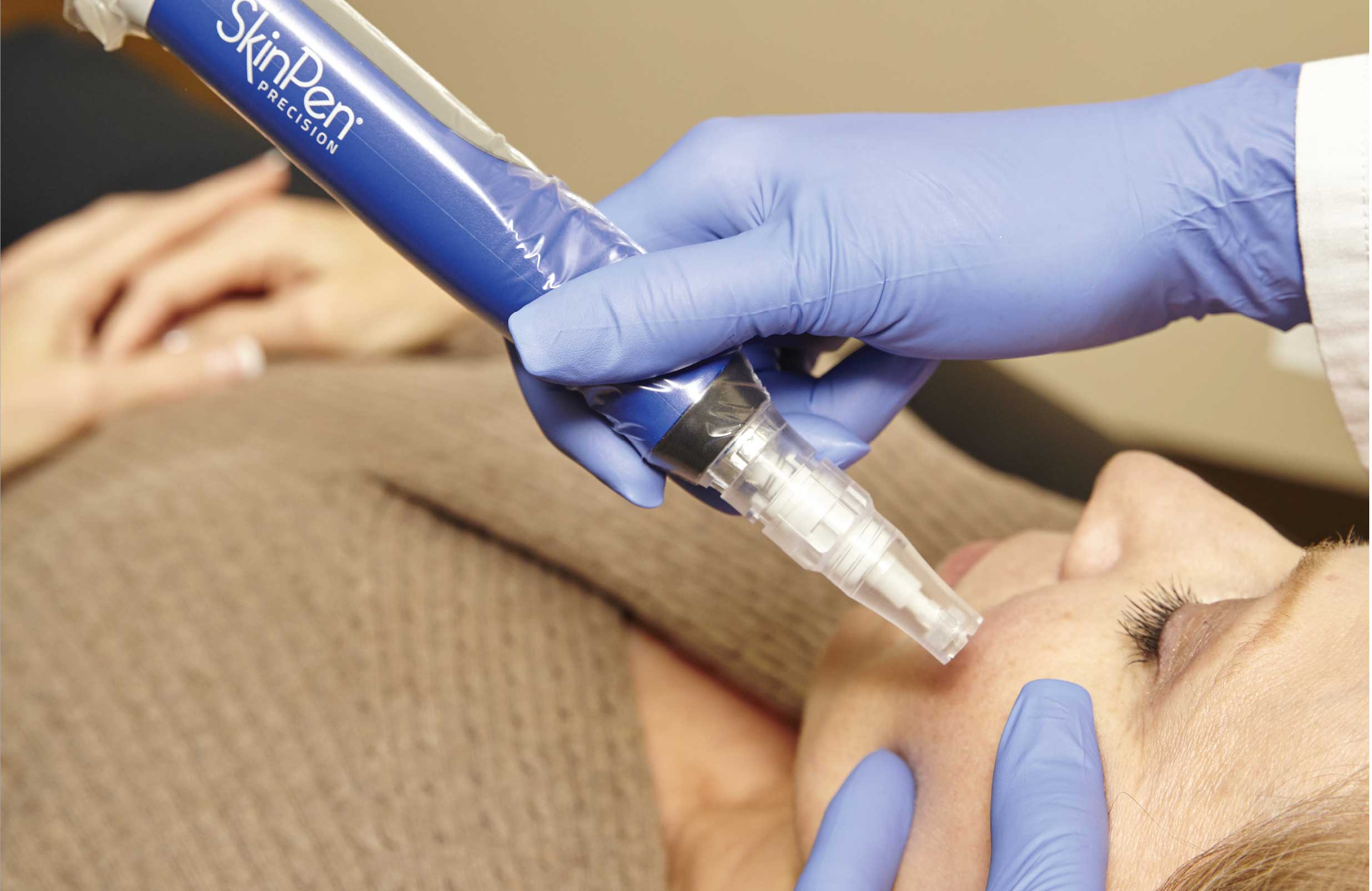 Skinpen In Action