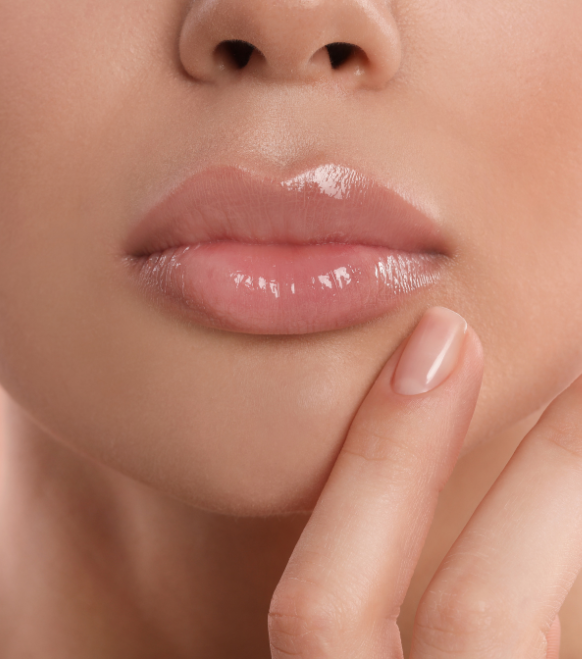 Natural Lip Filler