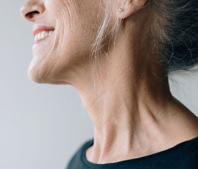 Microneedling For Neck Wrinkles And Skin Laxity Des Moines Neck Wrinkles And Skin Laxity Treated With Microneedling At Coachlight