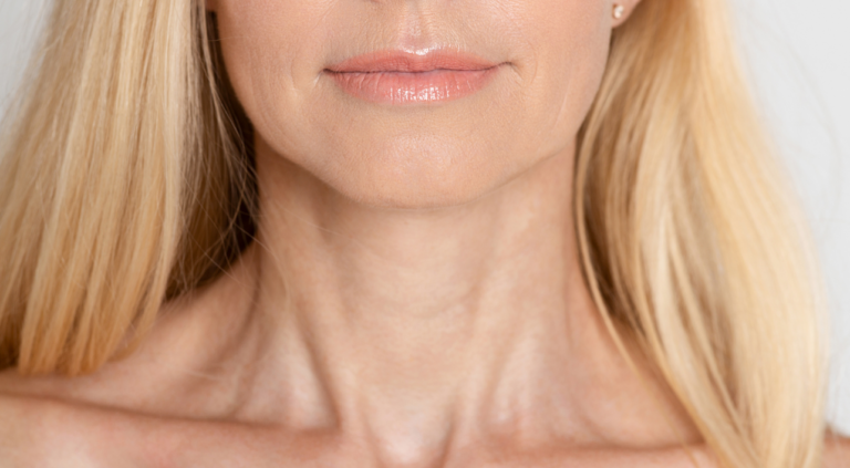 Close-Up Of The Lower Face And Neck Of A Middle-Aged Woman With Smooth Skin And Light Blonde Hair.