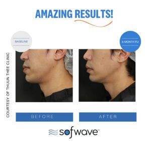 Set Lower Face Skin Type