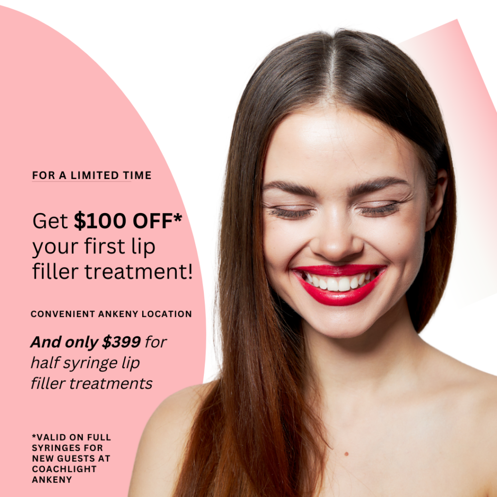 Ankeny Specific Lip Filler Promo