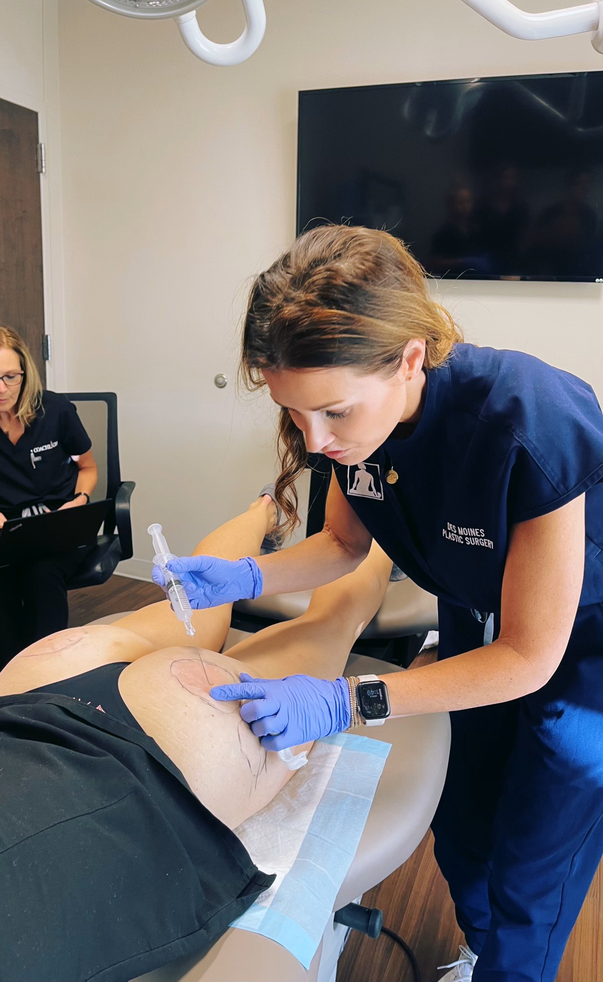 Sculptra Body Treatment