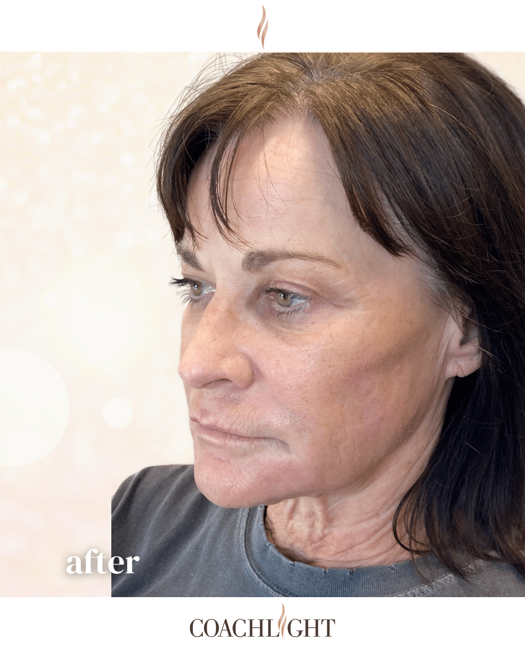 Facial Balancing ()