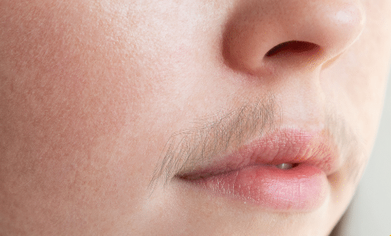 Laser Hair Removal 2 Laser Hair Removal