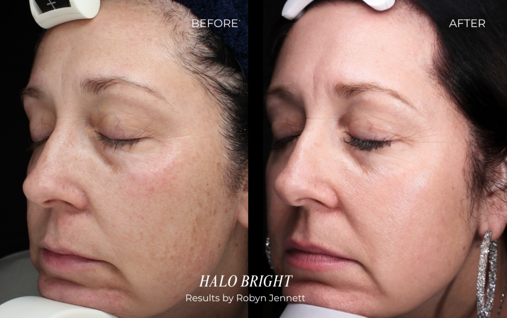 Halo Bright Before And After